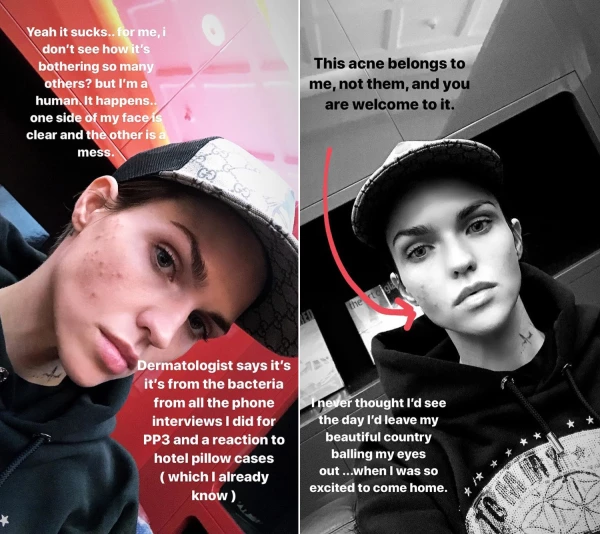 Ruby Rose