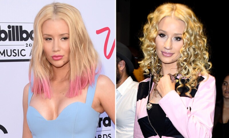 En 2015 Iggy se sometió a una rinoplastia y a un implante de barbilla.