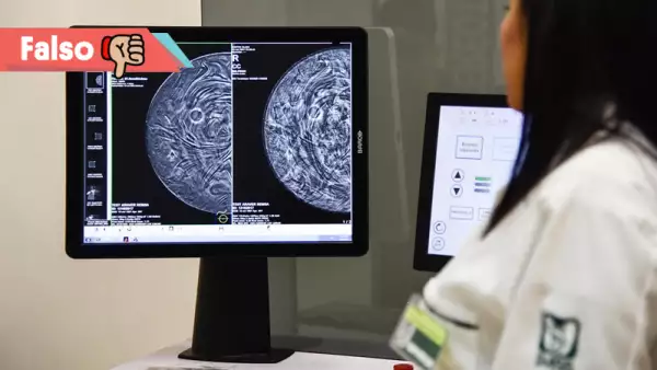 El IMSS