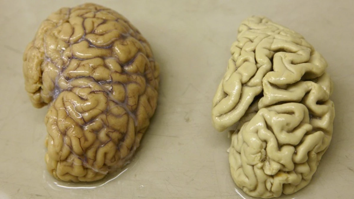 brain