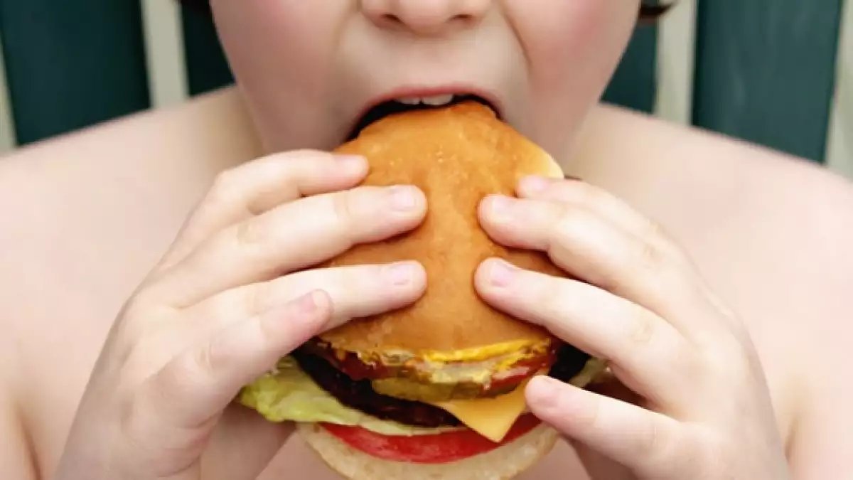 comida rapida obesidad infantil