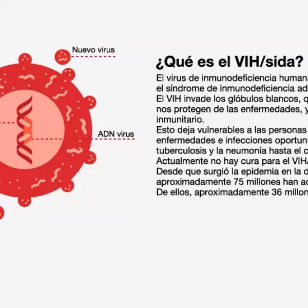 infografia VIH