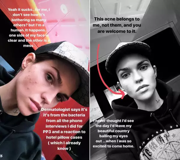 Ruby Rose
