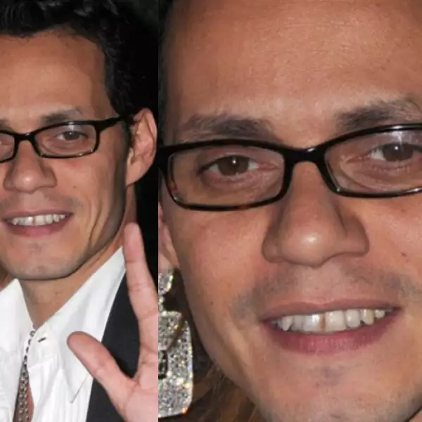 Marc Anthony parece no saber lo que es un dentista, pues tiene los dientes chuecos, amarillentos y hasta con manchas.