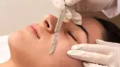 dermaplaning