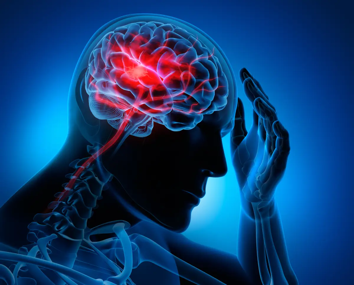 accidente-cerebrovascular