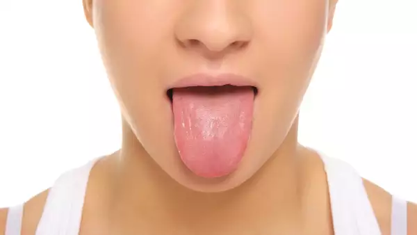 ¿Qué dice acerca de tu salud el color de tu lengua?