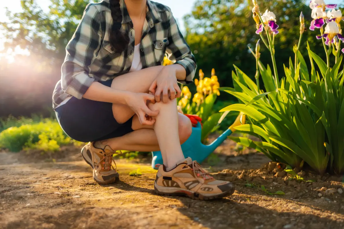 Summer,Season.,Woman,Scratches,Her,Leg,,Which,Is,Itchy,From