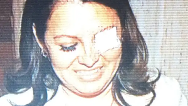 Karen Quiroga, diputada perredista, tuvo un altercado con la diputada Landy Berzunza (en la foto), del PRI, quien tuvo una herida al interior de su ojo tras los arañazos y empujones.