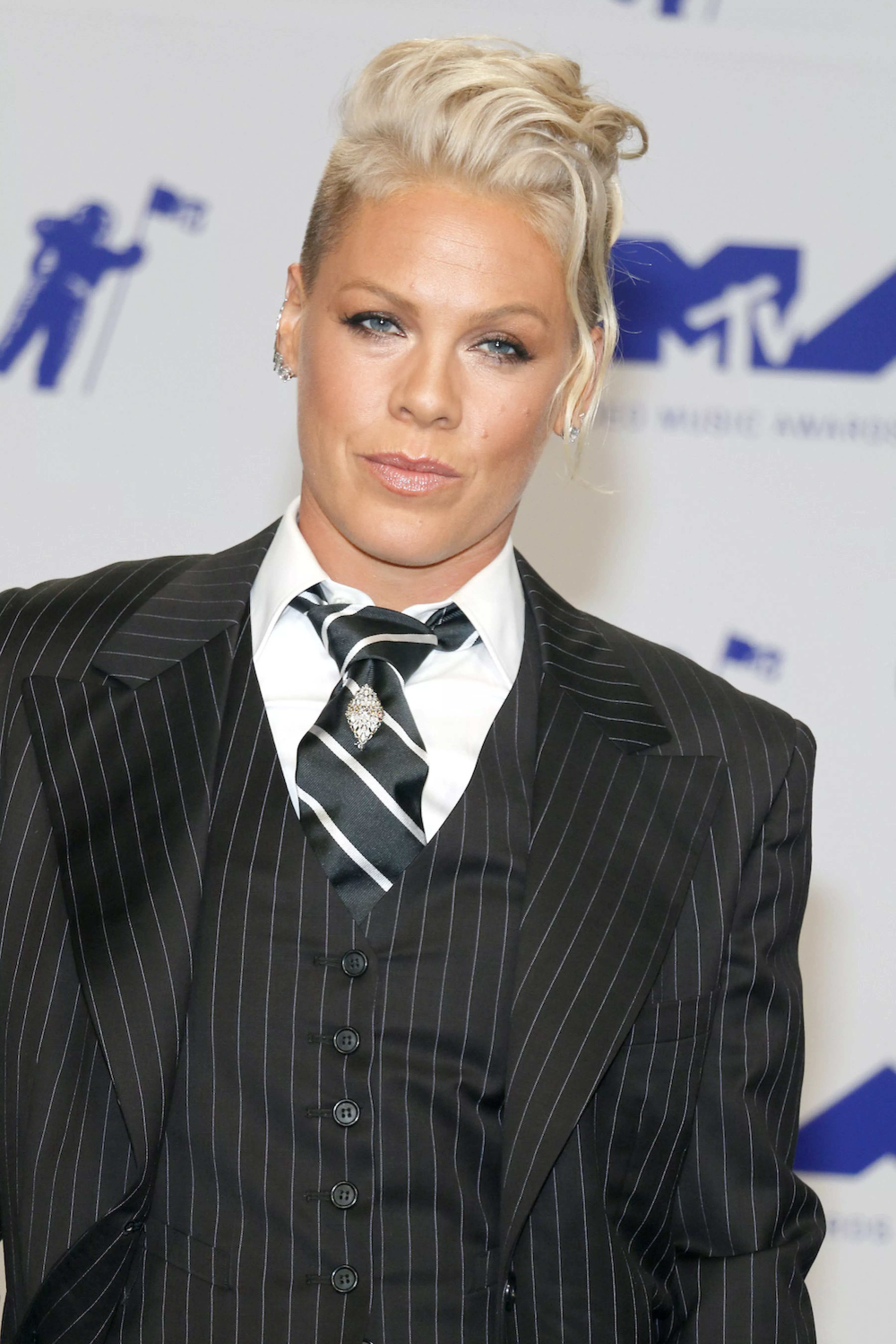 Pink se rompe el tobillo tras superar el covid