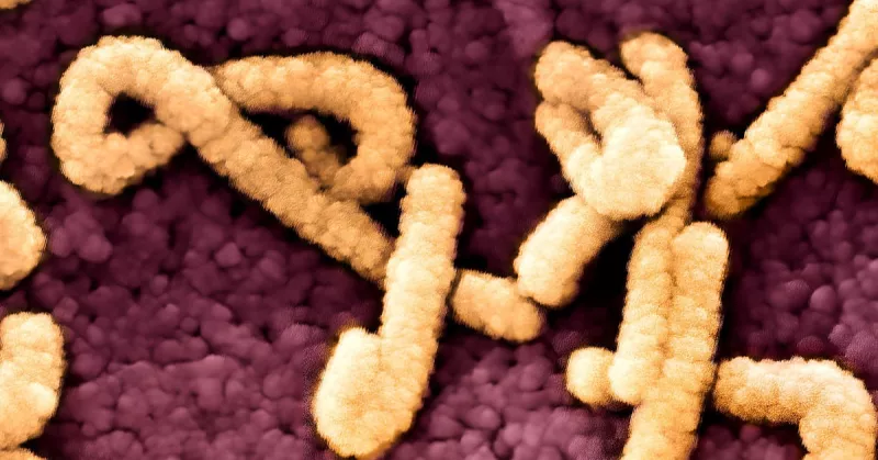 Colorized scanning electron micrograph of Marburg virus particles (yellow) both budding and attached to the surface of a