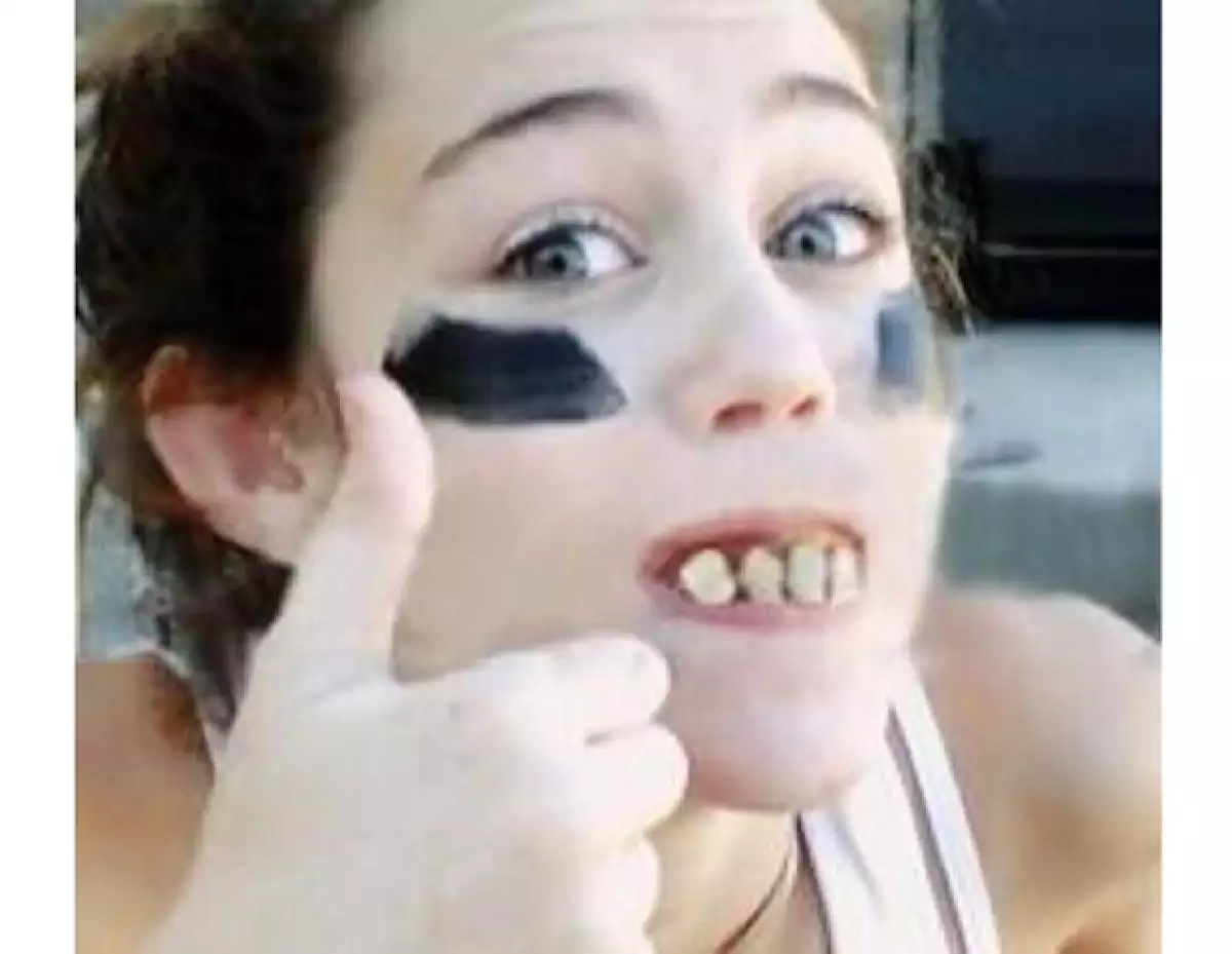 Miley con otro tipo de dentadura pero igual de tosca que la primera.