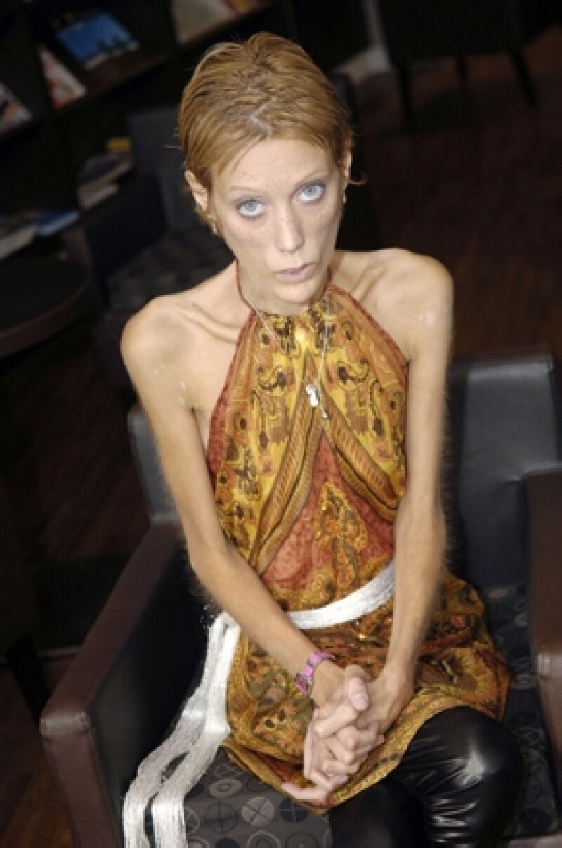 La modelo francesa perdió la batalla contra la anorexia.