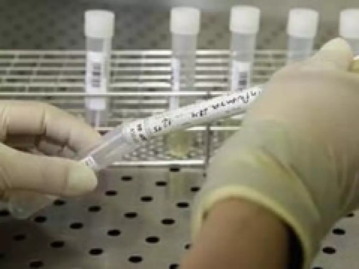 Los reportes de contagiados por el virus de la gripe porcina han aumentado. (Foto: Reuters)