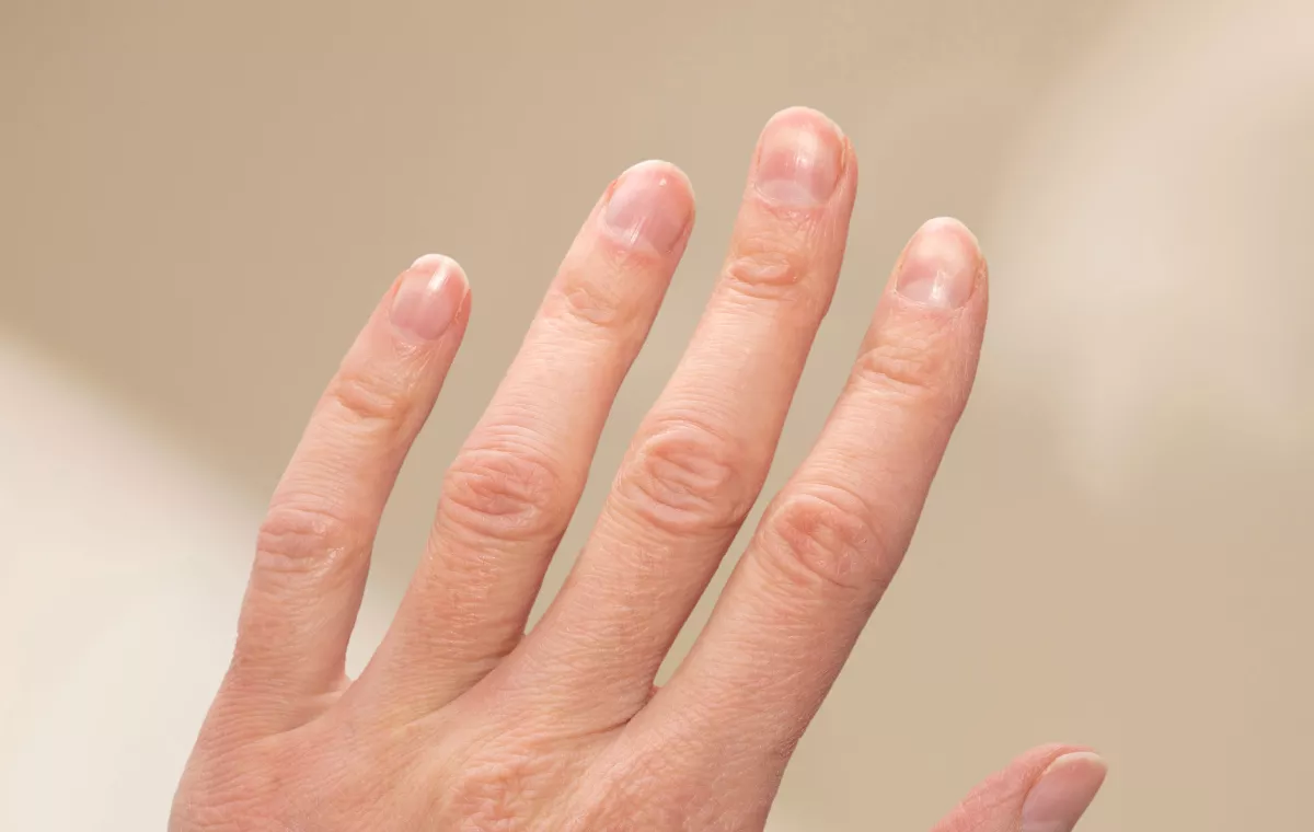 UÑAS FRÁGILES