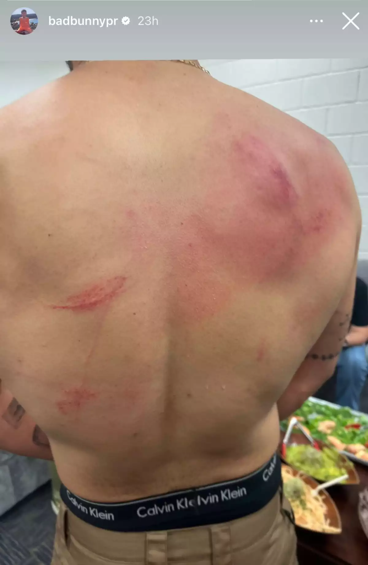 bad-bunny-pelea-wwe