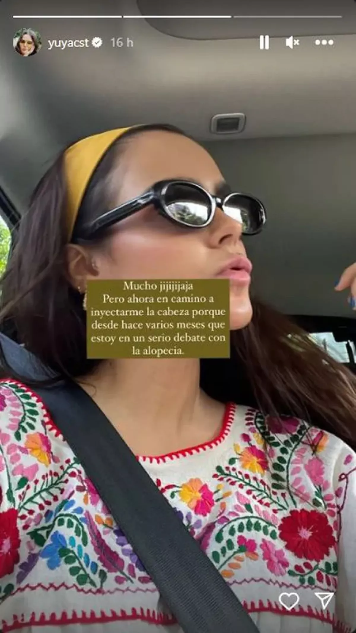 yuya-revela-que-tiene-alopecia.jpg