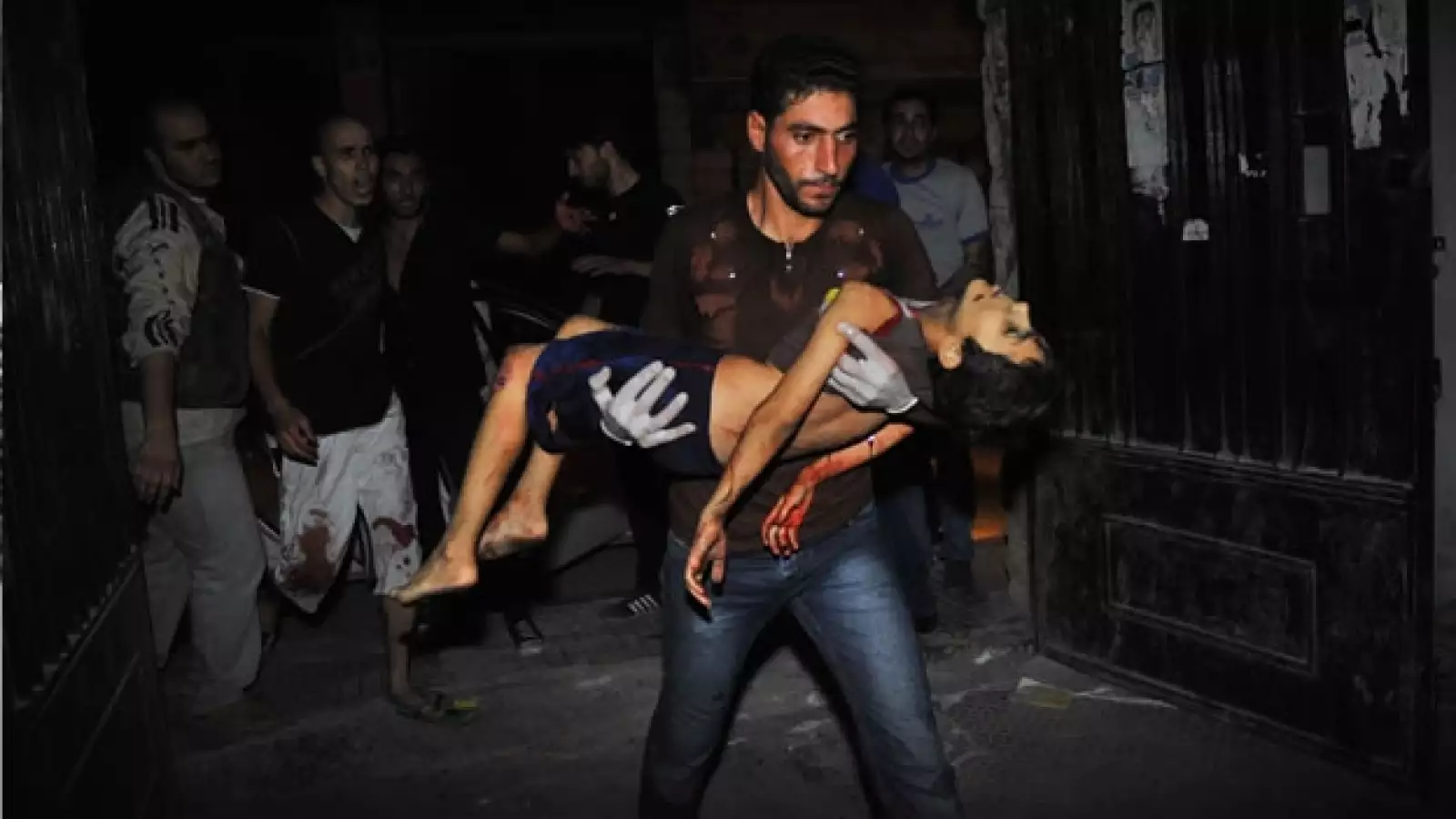 ataques siria, guerra, conflicto, heridos, niño, niña