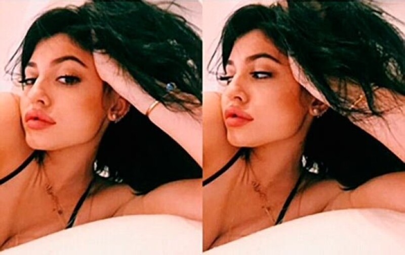 Los voluminosos labios de Kylie Jenner han sido causa de innumerables comentarios por parte de sus seguidores.