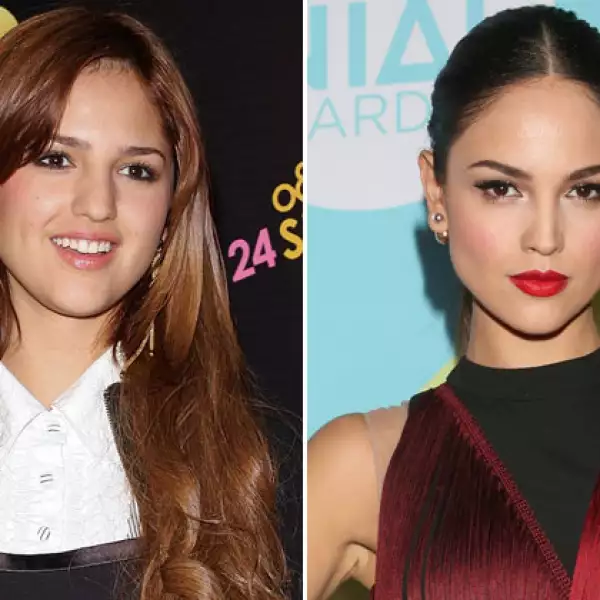 La actriz Eiza González reconoció en 2011 haberse sometido a cirugías para afinar su rostro y aclaró que no usaría pretextos de salud para justificar la intervención, pues todo se debió a un gusto personal.