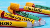 La influenza H3N2 se expande y causa hospitalizaciones en países: qué es y cuáles son sus síntomas