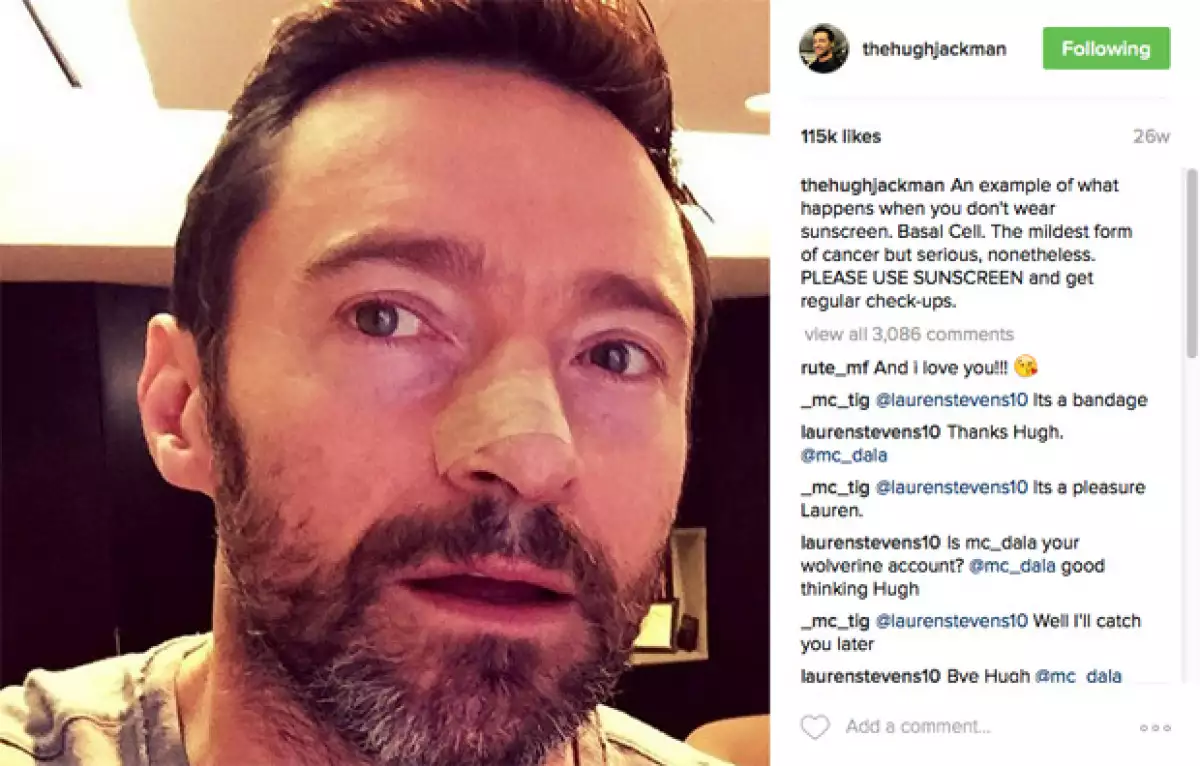 Hugh Jackman ha compartido una foto de casa una de sus cirugías, aquí la de la última.