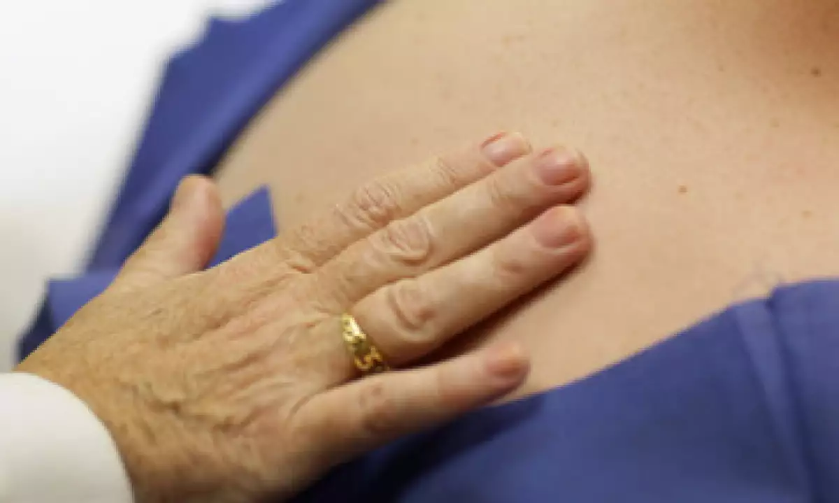 El cáncer de piel se puede esparcir a los pulmones, el hígado y el cerebro. (Foto: Getty Images )