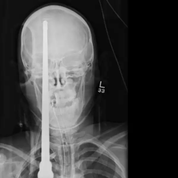 disparo, lanza, sobrevive, 