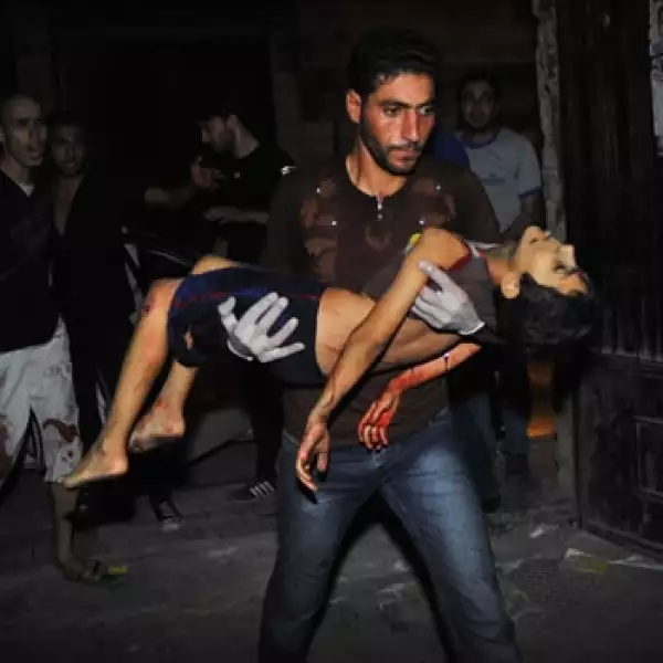 ataques siria, guerra, conflicto, heridos, niño, niña