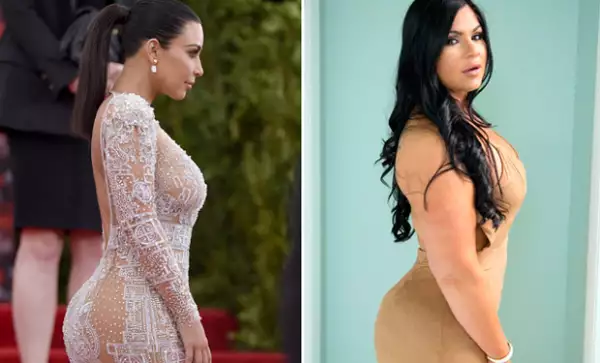Marlene gastó 10 mil dólares para obtener el mismo booty que Kim Kardashian.
