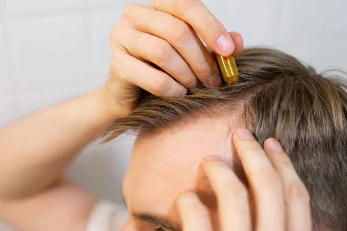 Medicación para controlar la caída del pelo