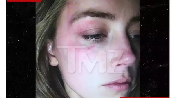 Según informa TMZ, la actriz mostró una imagen en la corte en la que aparece con la cara golpeada, alegando que el actor había sido el responsable de ello.