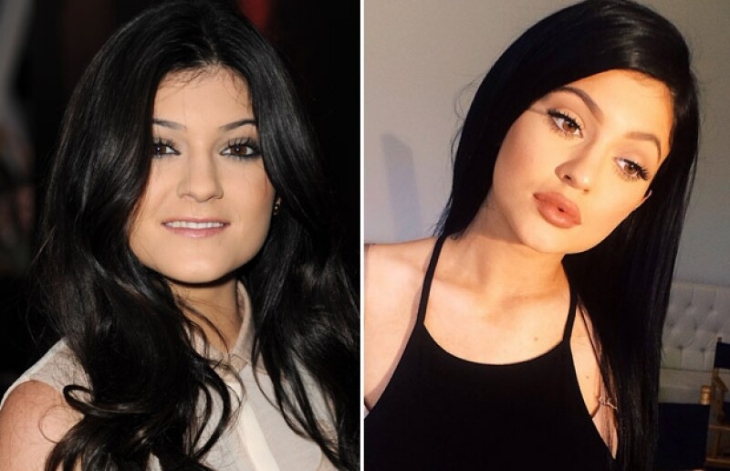 La evolución del tamaño de los labios de Kylie Jenner este año fue más que evidente. Izquierda: noviembre de 2011 Derecha: agosto 2014