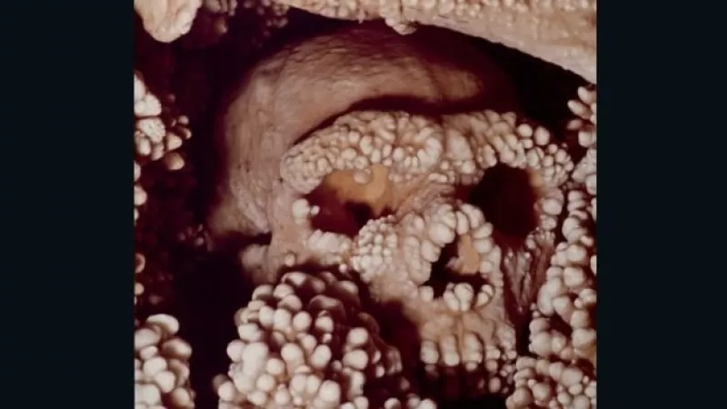 adn neardental italia