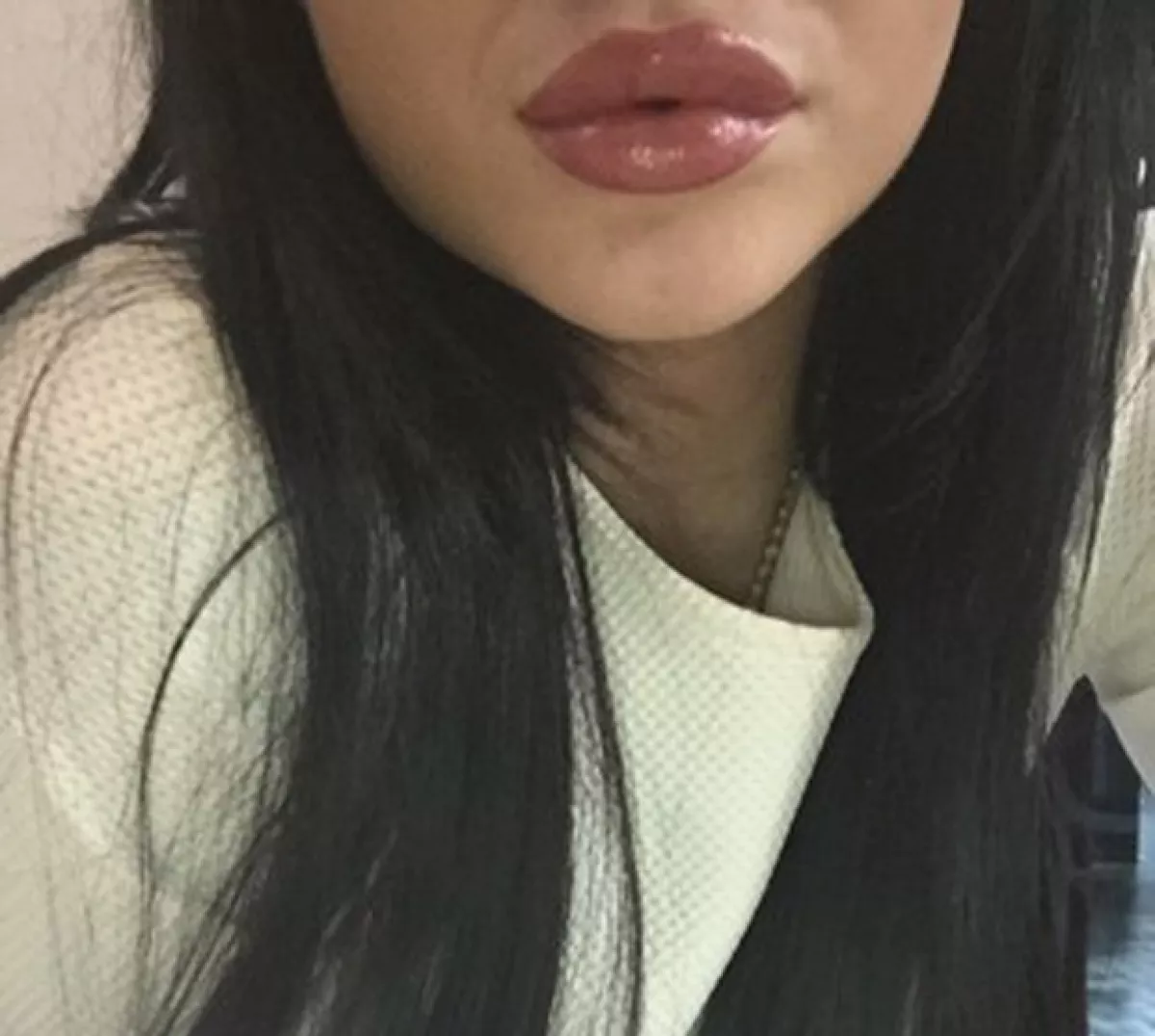 Esta fue otra de las imágenes que compartió Jenner donde el crecimiento de sus labios es más que evidente.