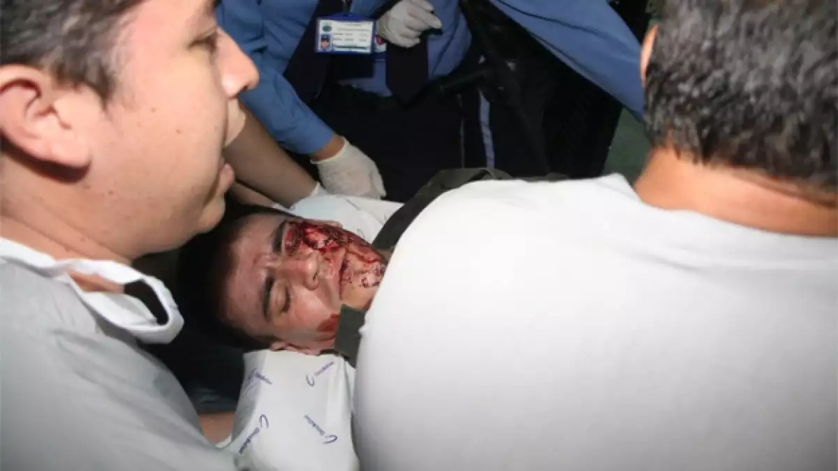 policia herido en atentado en colombia