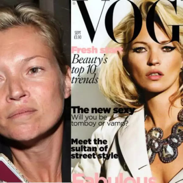 La cara de la supermodelo Kate Moss no ha librado de todo el paso del tiempo, aunque en las portadas de revistas parezca lo contrario.
