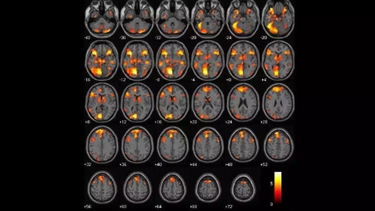 moralidad cerebro