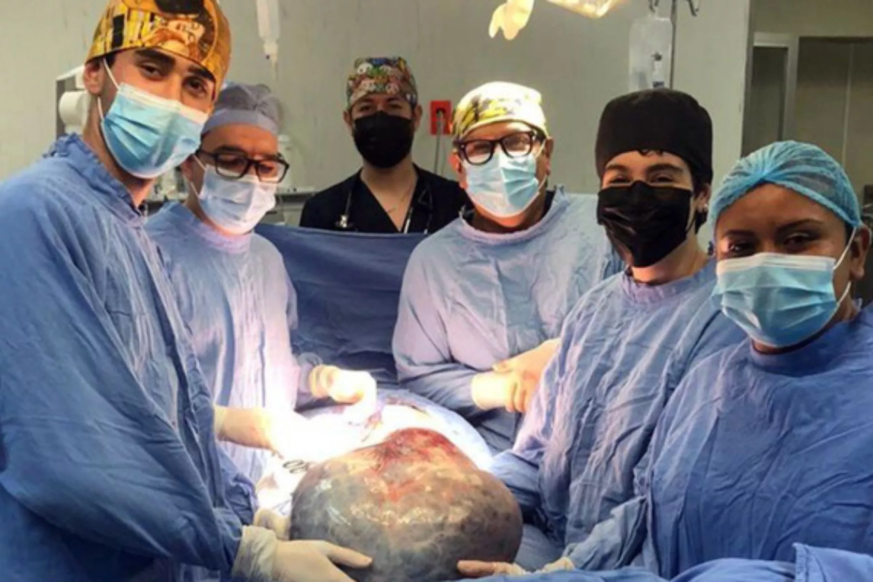 retiran-tumor-21-kilos.jpg