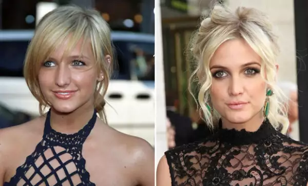 La hermana de Jessica Simpson hizo un retoque a su nariz, lo que le hizo lucir un rostro más afilado.