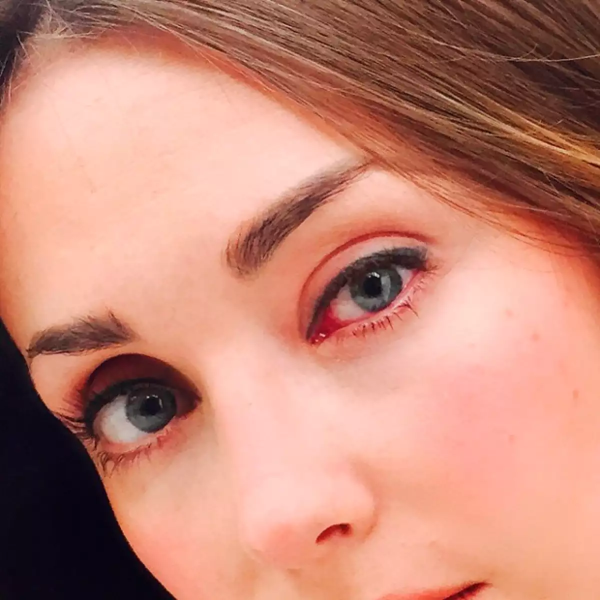 La actriz y cantante compartió en su Instagram fotografías sobre su estado de salud, en las que dejó ver lo afectados que tenía sus ojos