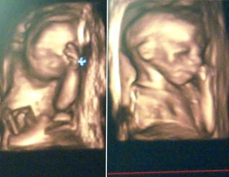 Como todo padre orgulloso y emocionado por el nacimiento de sus primeros bebés, Martín publicó este sábado las primeras imágenes del ultrasonido que le hicieron a la ex reina de belleza.