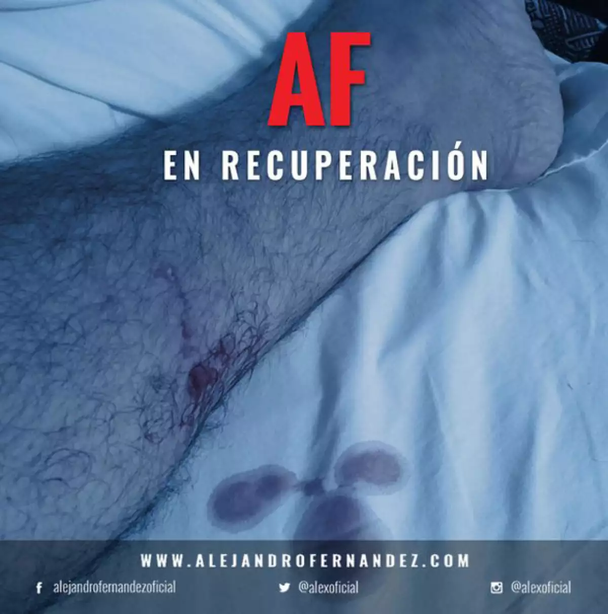 Con esta imagen, Alejandro informó a sus fans que a pesar del accidente se encontraba bien.