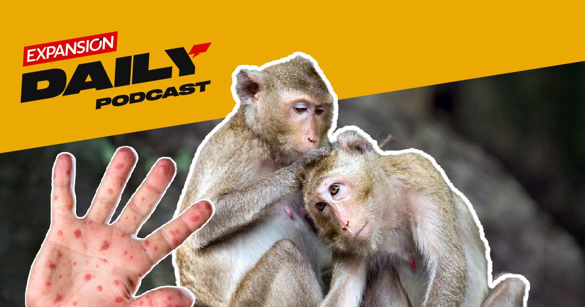 #podcast | Expansión Daily: Monkeypox infections increase #podcast | Expansión Daily: Monkeypox infections increase
