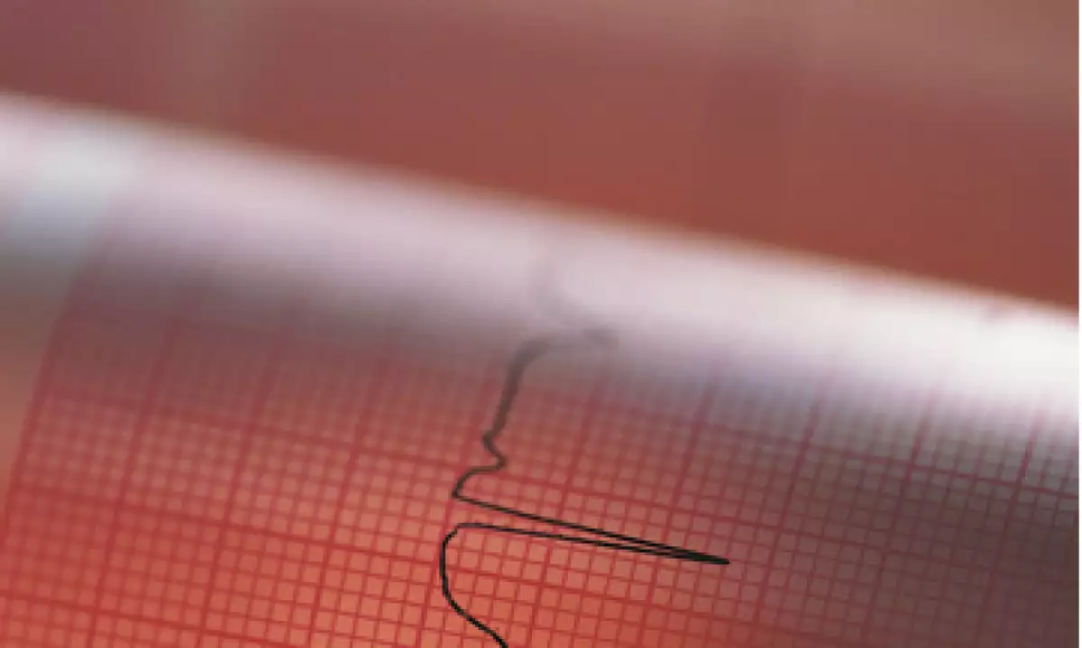 Aún en un escenario adverso, la banca mexicana resistió la prueba de estrés. (Foto: Thinkstock.)