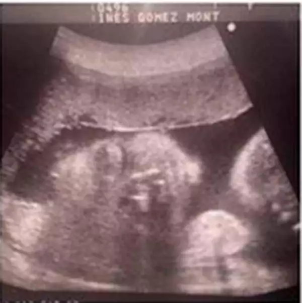 Este es el primer ultrasonido que la conductora comparte de este, su tercer embarazo.