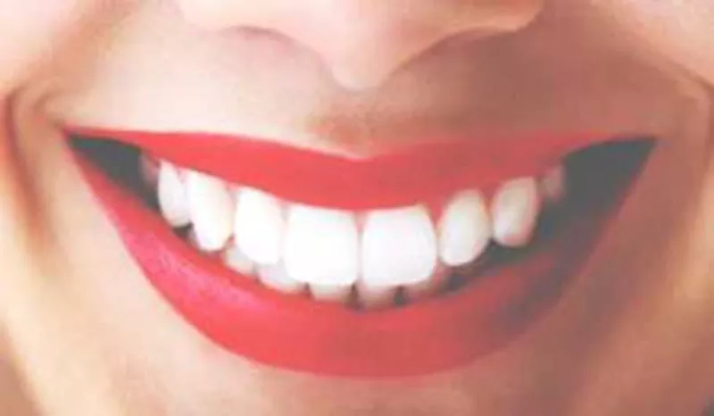 La sonrisa es el mejor accesorio y lo que queremos es conservar nuestros dientes blancos y perfectos. Aunque existen muchos tratamientos, hoy te contamos formas naturales de lograrlo.