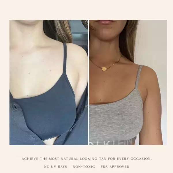 bodygold