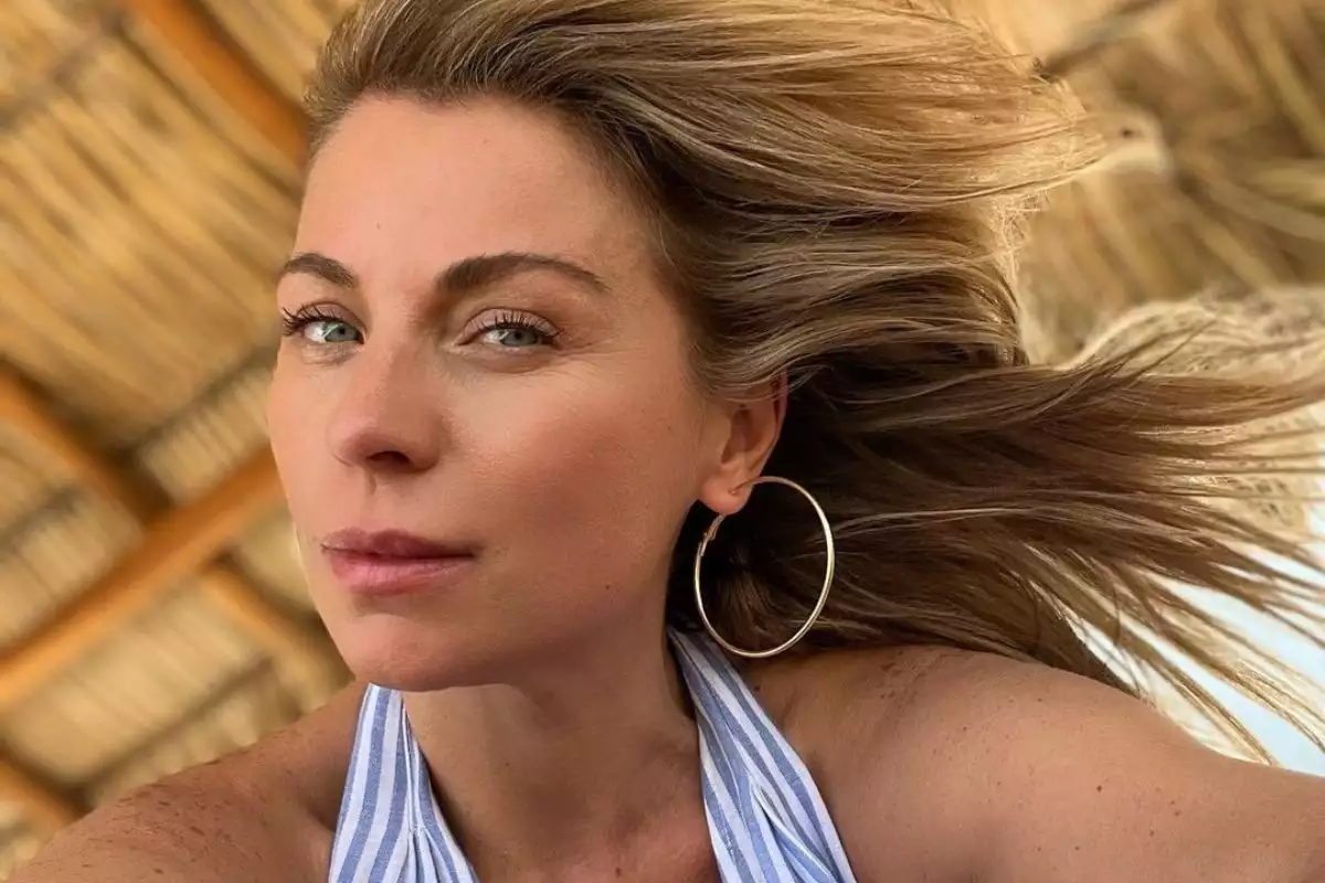 Ludwika Paleta mostró el tatuaje que le están borrando y cómo tratan la rosácea con láser