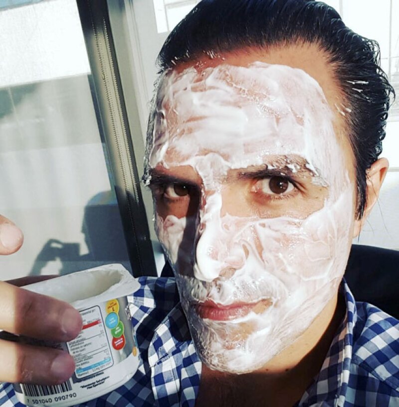 El yogurt también es bueno para las quemaduras.